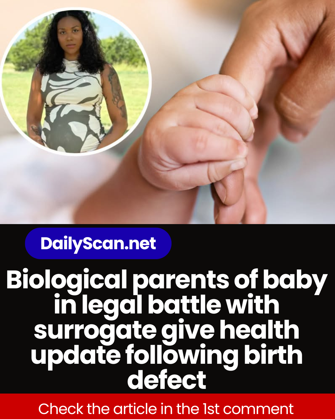 Biological parents of baby in legal battle with surrogate give health update following birth defect