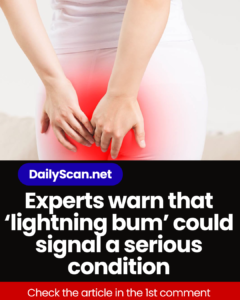 Experts warn that ‘lightning bum’ could signal a serious condition