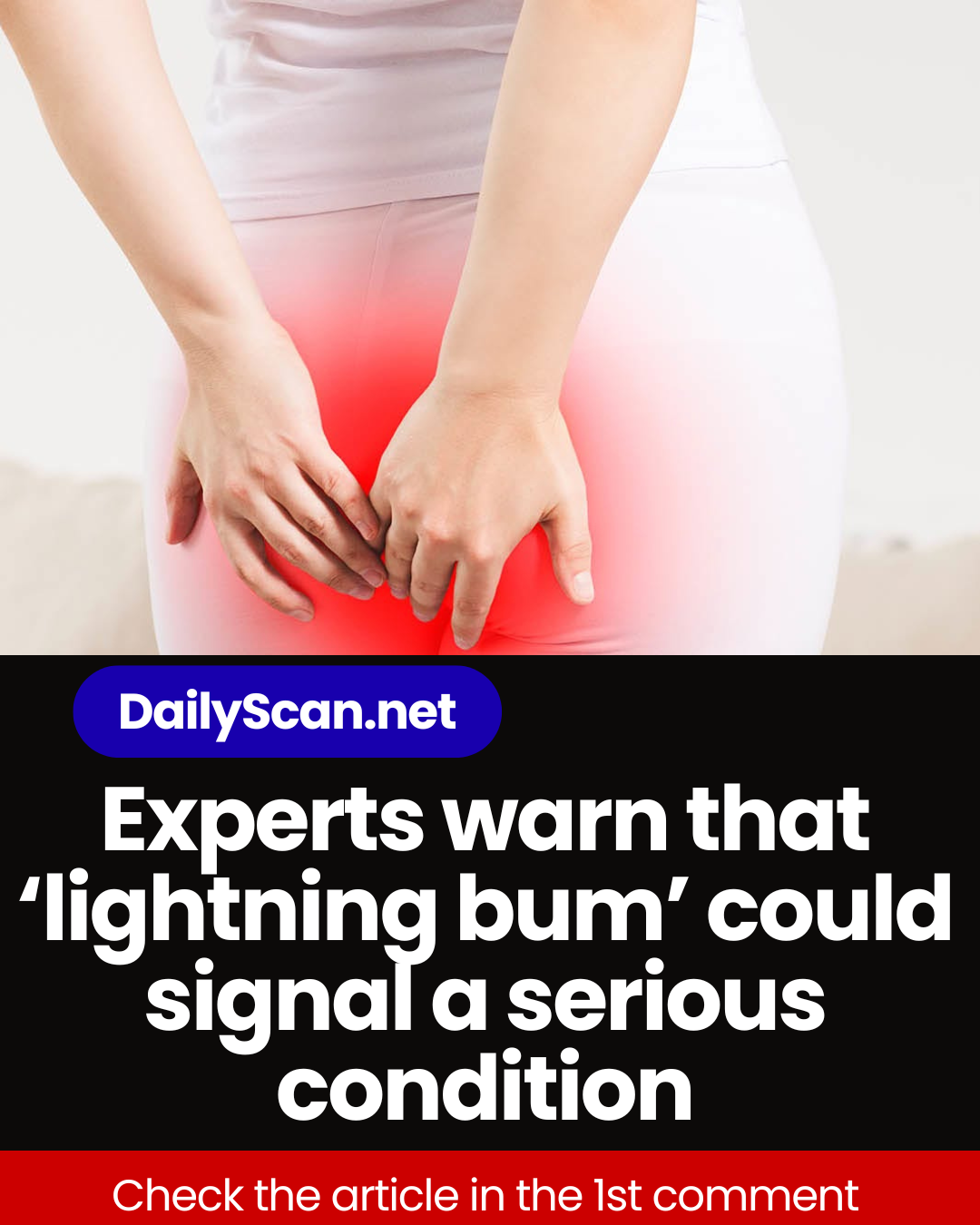 Experts warn that ‘lightning bum’ could signal a serious condition