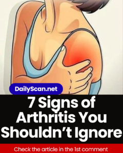 Signs of Arthritis You Shouldn’t Ignore
