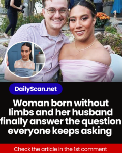 Woman born without limbs and her husband finally answer the question everyone keeps asking
