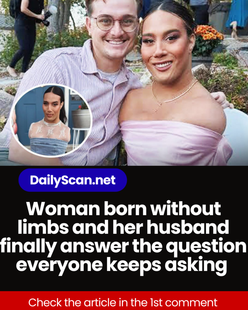 Woman born without limbs and her husband finally answer the question everyone keeps asking