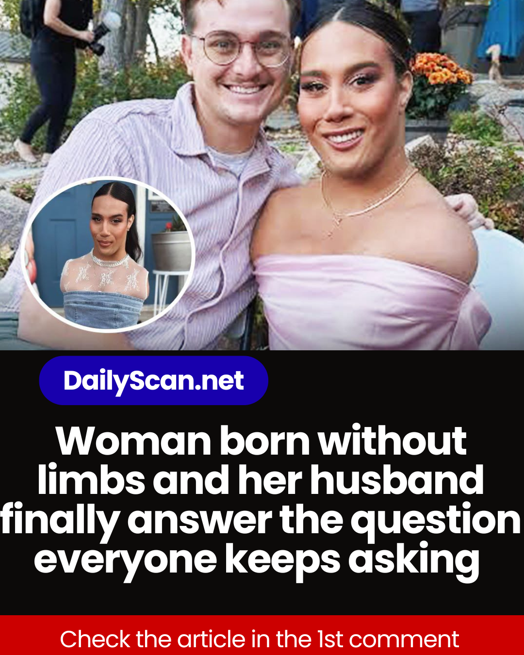 Woman born without limbs and her husband finally answer the question everyone keeps asking
