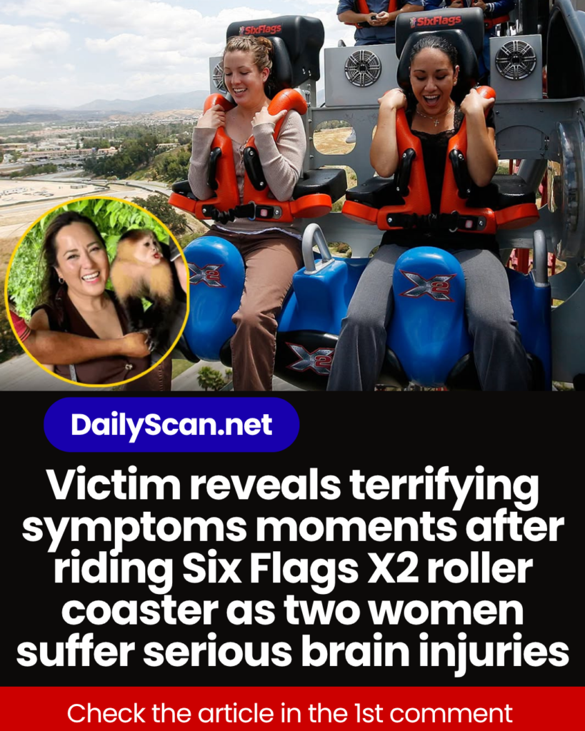 Victim reveals terrifying symptoms moments after riding Six Flags X2 roller coaster as two women suffer serious brain injuries