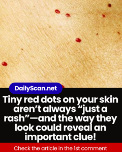 Red Dots on Your Skin: Causes and What They Could Mean…