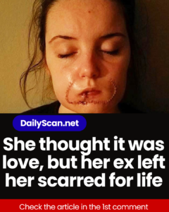 She thought it was love, but her ex left her scarred for life