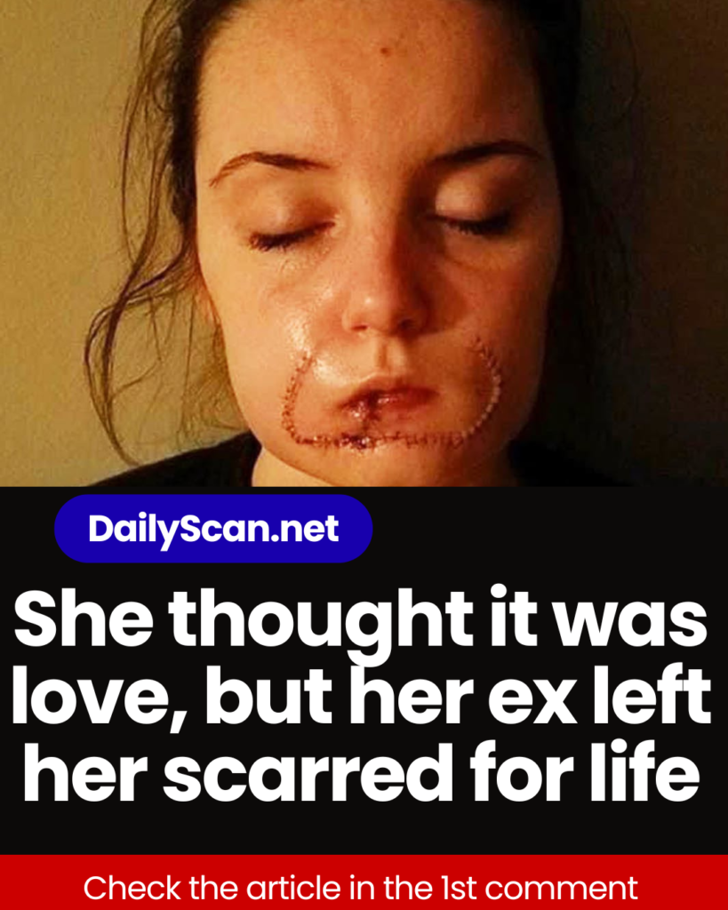 She thought it was love, but her ex left her scarred for life