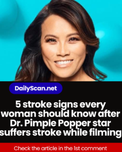 5 stroke signs every woman should know after Dr. Pimple Popper star suffers stroke while filming