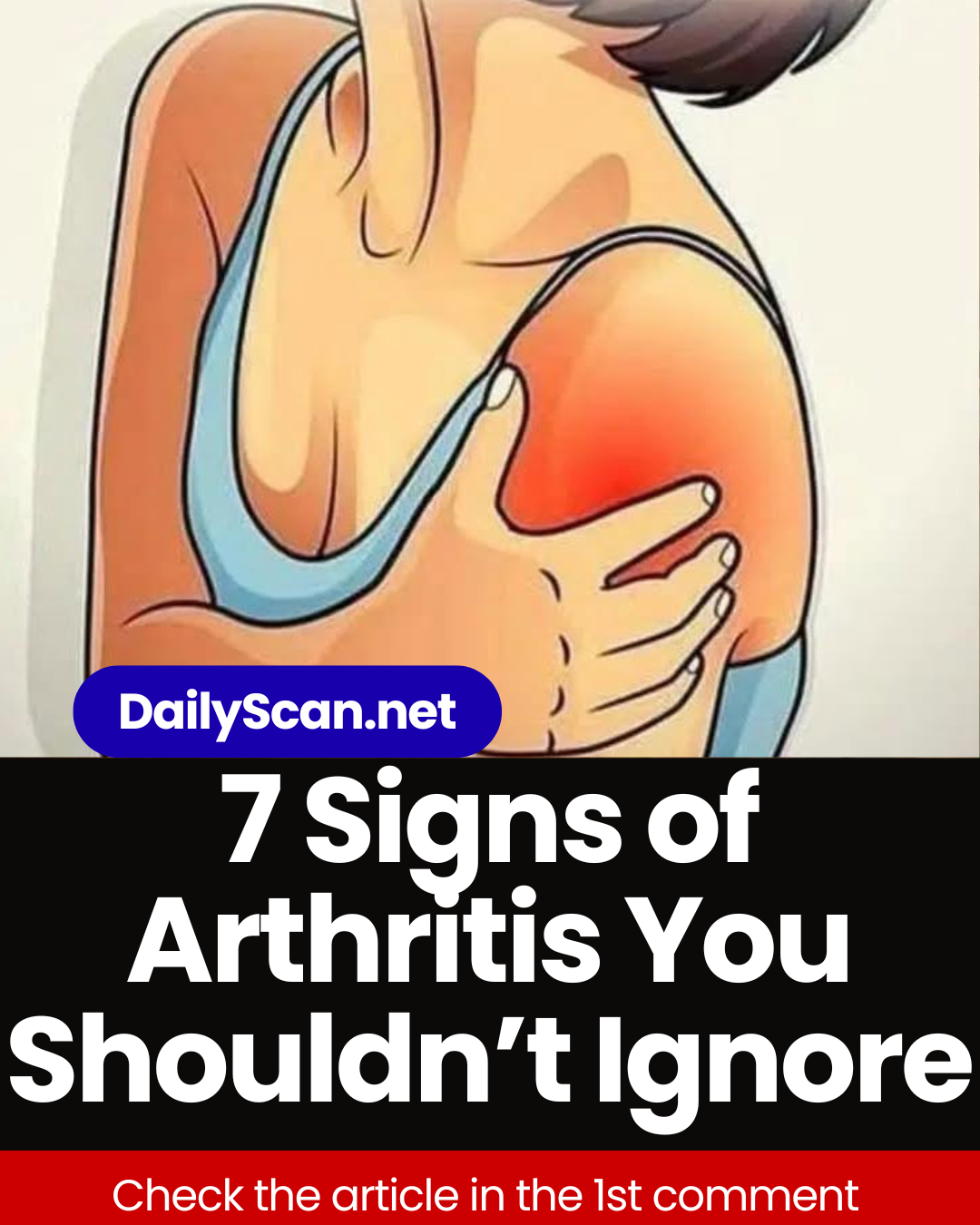 Signs of Arthritis You Shouldn’t Ignore