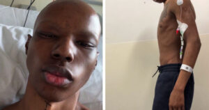 22-year-old told he has less than a year to live after stomach pain reveals ultra-rare cancer