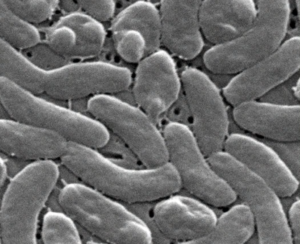 Florida reports another death from flesh-eating bacteria Vibrio vulnificus