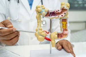 Concerning rise in colon cancer deaths is almost entirely among key demographic