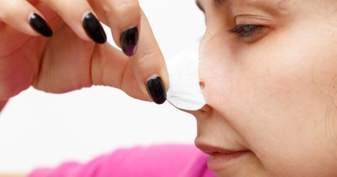 Woman’s dog alerted her to deadly disease which lead to her prosthetic nose