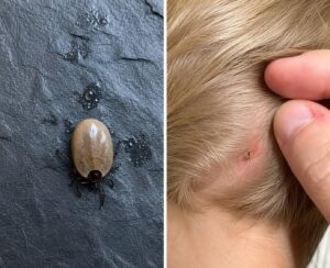 Unwanted Visitors in Your Child’s Hair