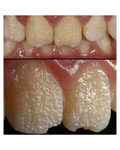 Be careful!! This is what your teeth will become when you eat…
