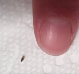 Head lice: How to get rid of them and stop them coming back