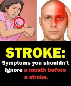 Warning signs of stroke your body might be sending