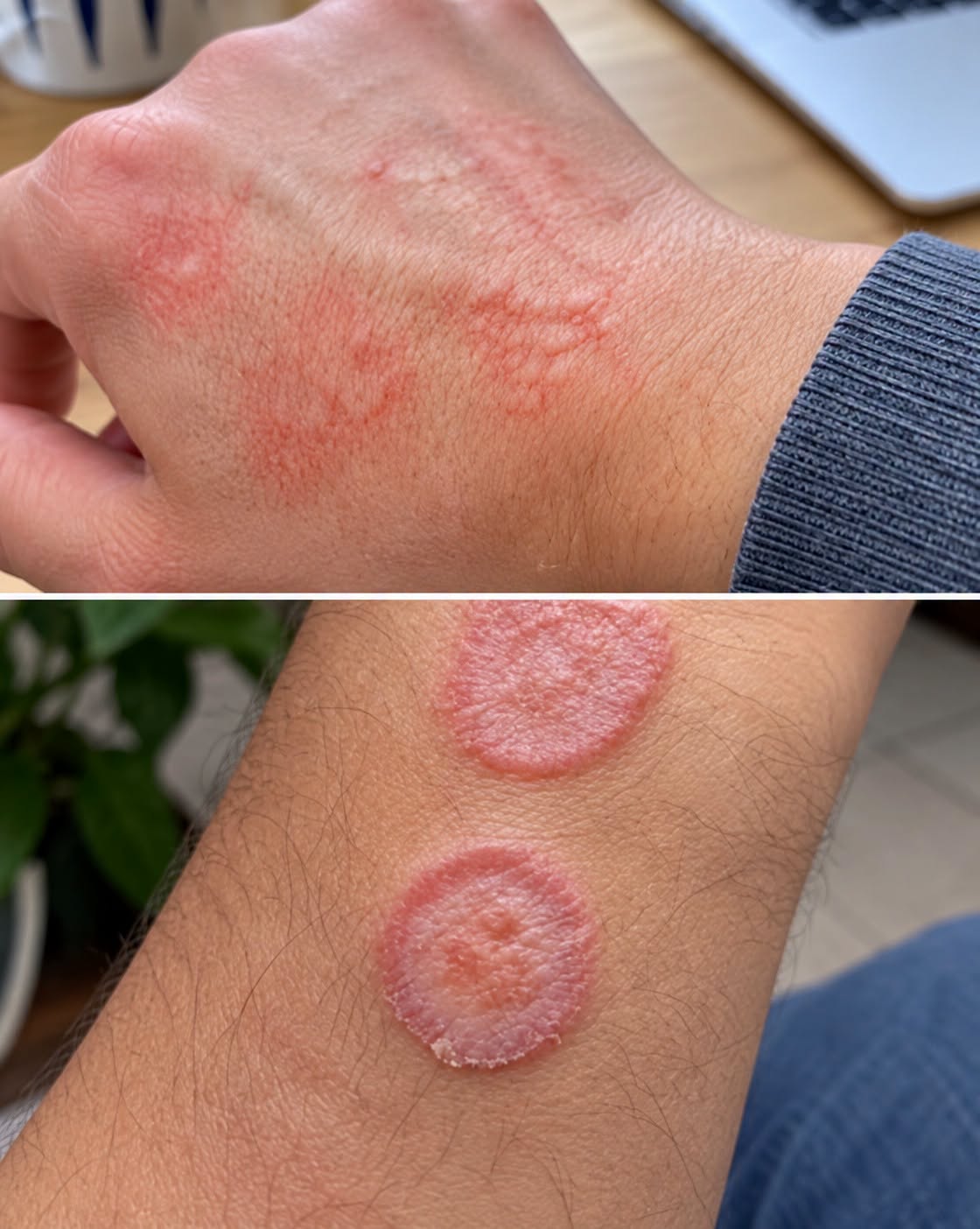 Hidden Warning: When Unusual Skin Changes Shouldn’t Be Ignored