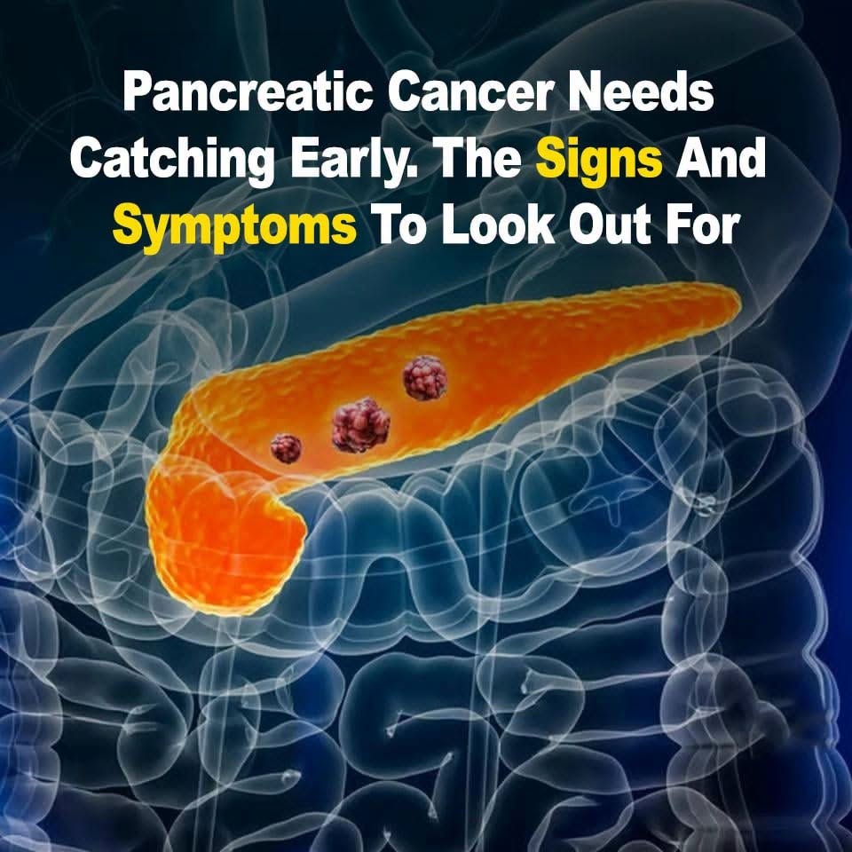 10 Signs of Pancreatic Cancer You Should Never Ignore