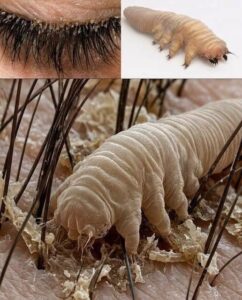 The Tiny Creatures Living Closer Than You Think: What Everyone Should Know About Eyelash Mites
