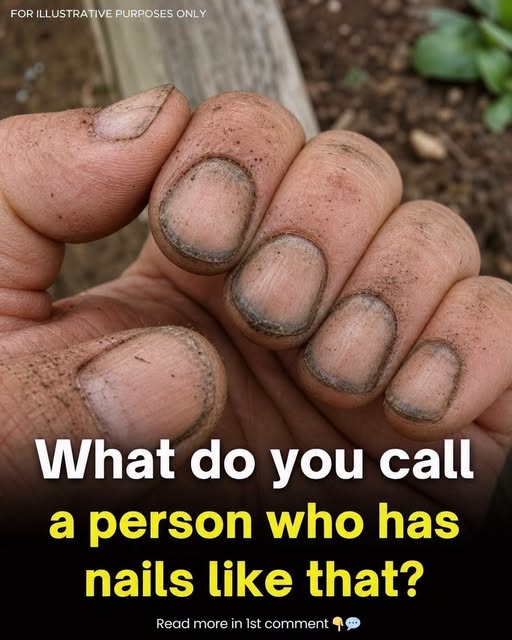 What Dirty Fingernails Really Reveal
