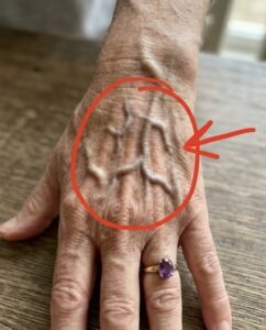 If your veins are visible, it means you… Show more