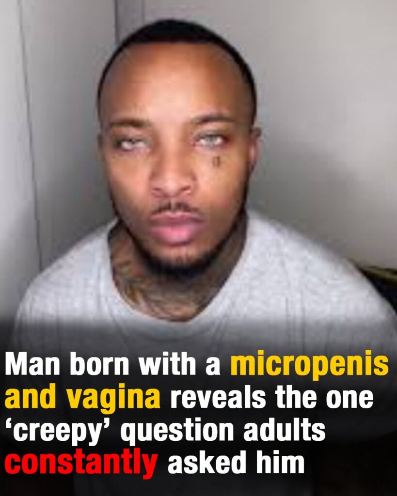 Man born with micropenis and vagina reveals extremely creepy ask he used to get from adults