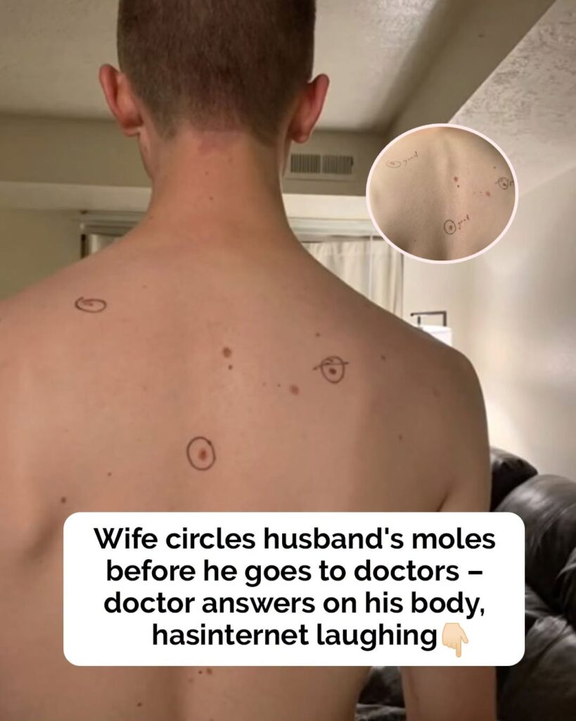 Woman sends husband to dermatologist with marks on his body – doctor plays along
