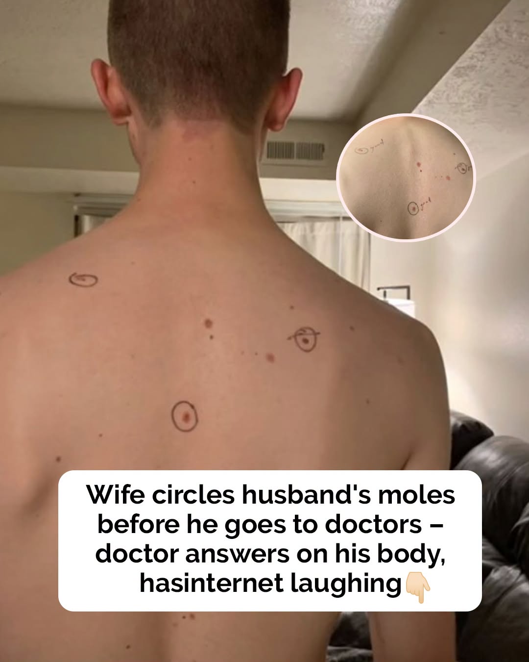 Woman sends husband to dermatologist with marks on his body – doctor plays along
