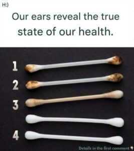 Our ears reveal our true state of health