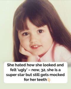 She hated her body and felt ‘ugly’ – at 32, she’s a super star, but still gets mocked for her teeth