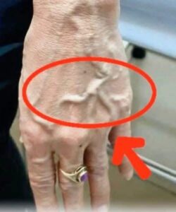 Why are your veins suddenly bulging and visible?