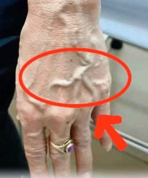 Why are your veins suddenly bulging and visible?