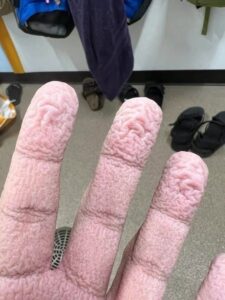 Wrinkled Fingers After Water Exposure: The Shocking Biological Truth Behind Your Skin’s Creepy Reaction