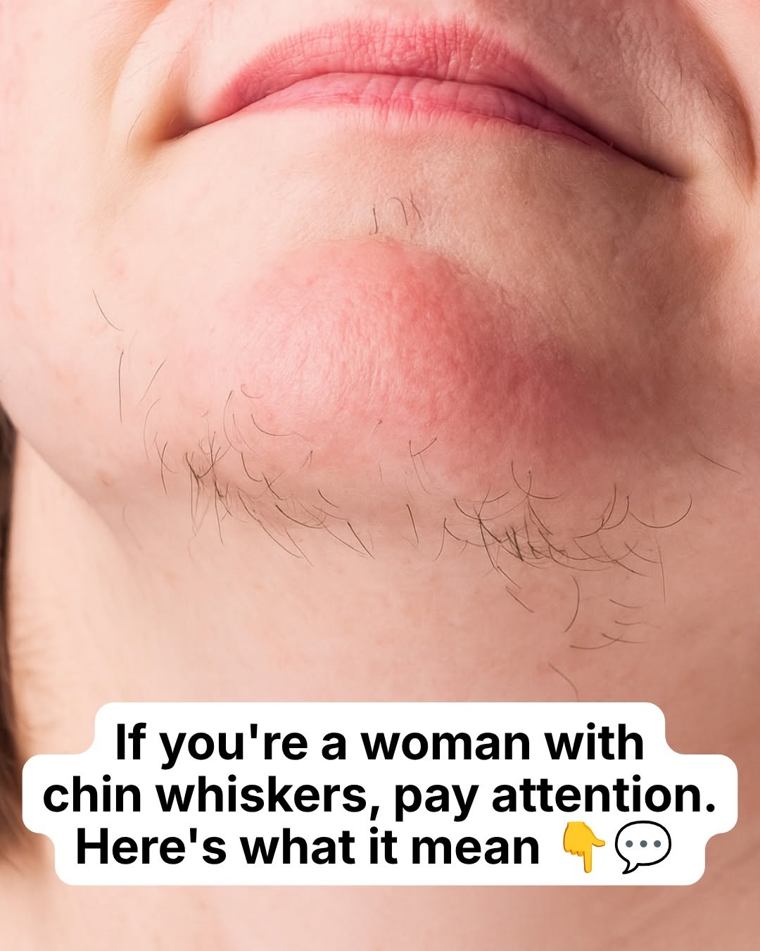 If You’re a Woman With Chin Whiskers, Here’s What Your Body May Be Telling You