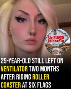 25-year-old still left on ventilator two months after riding roller coaster at Six Flags