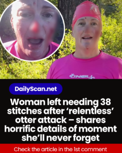Woman left needing 38 stitches after ‘relentless’ otter attack – shares horrific details of moment she’ll never forget
