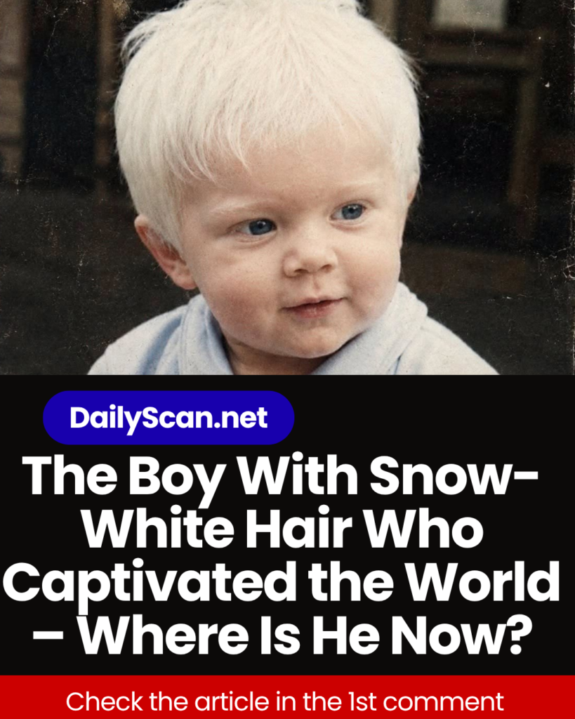 The Boy With Snow-White Hair Who Captivated the World – Where Is He Now?