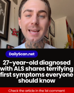 27-year-old diagnosed with ALS shares terrifying first symptoms everyone should know