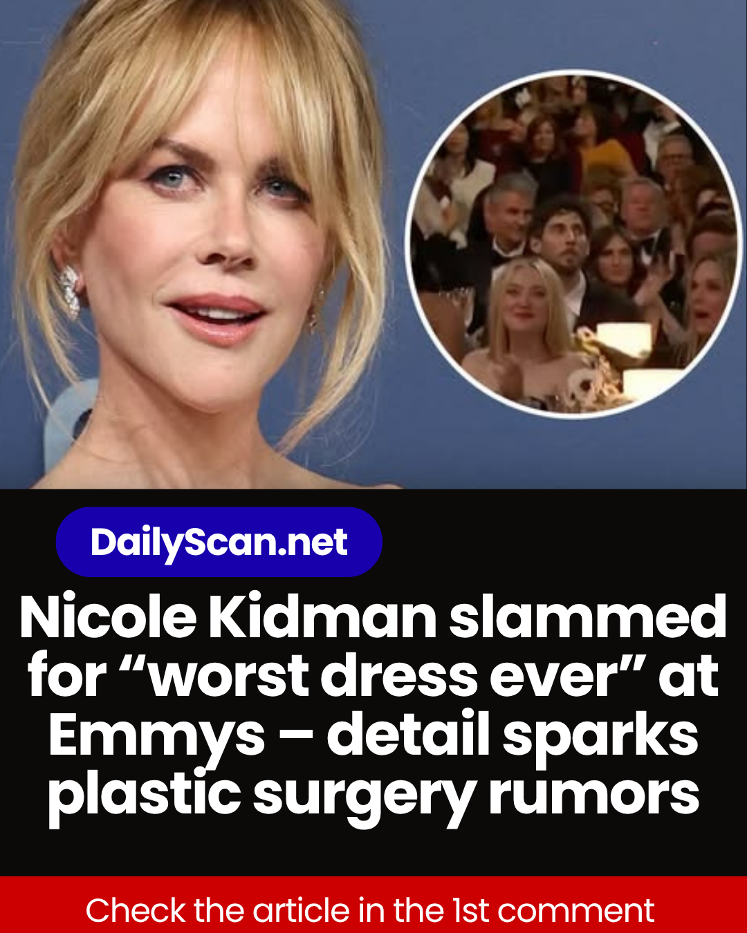 Nicole Kidman slammed for “worst dress ever” at Emmys – detail sparks plastic surgery rumors