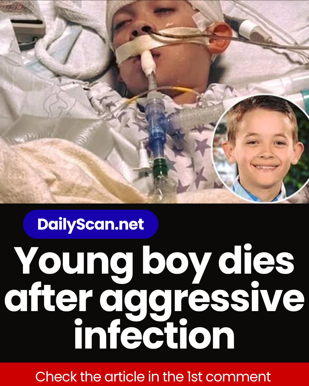 Young boy dies after aggressive infection