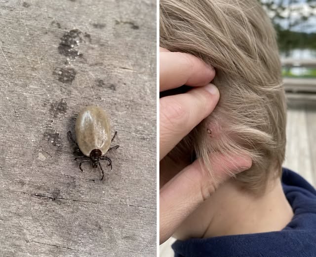 What Kind of Bug Is That? A Parent’s Guide to an Unusual Insect Found on a Child’s Scalp