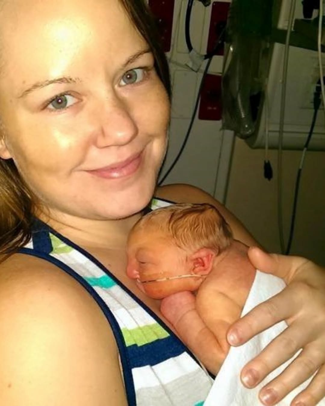 ‘Miracle baby’ born without most of his brain defied all odds – tragic update