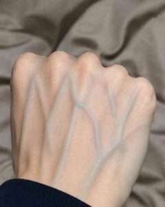 If you have visible veins, it means…