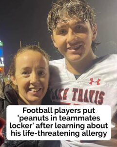 Football players “deliberately put peanuts in severely allergic teammate’s locker”