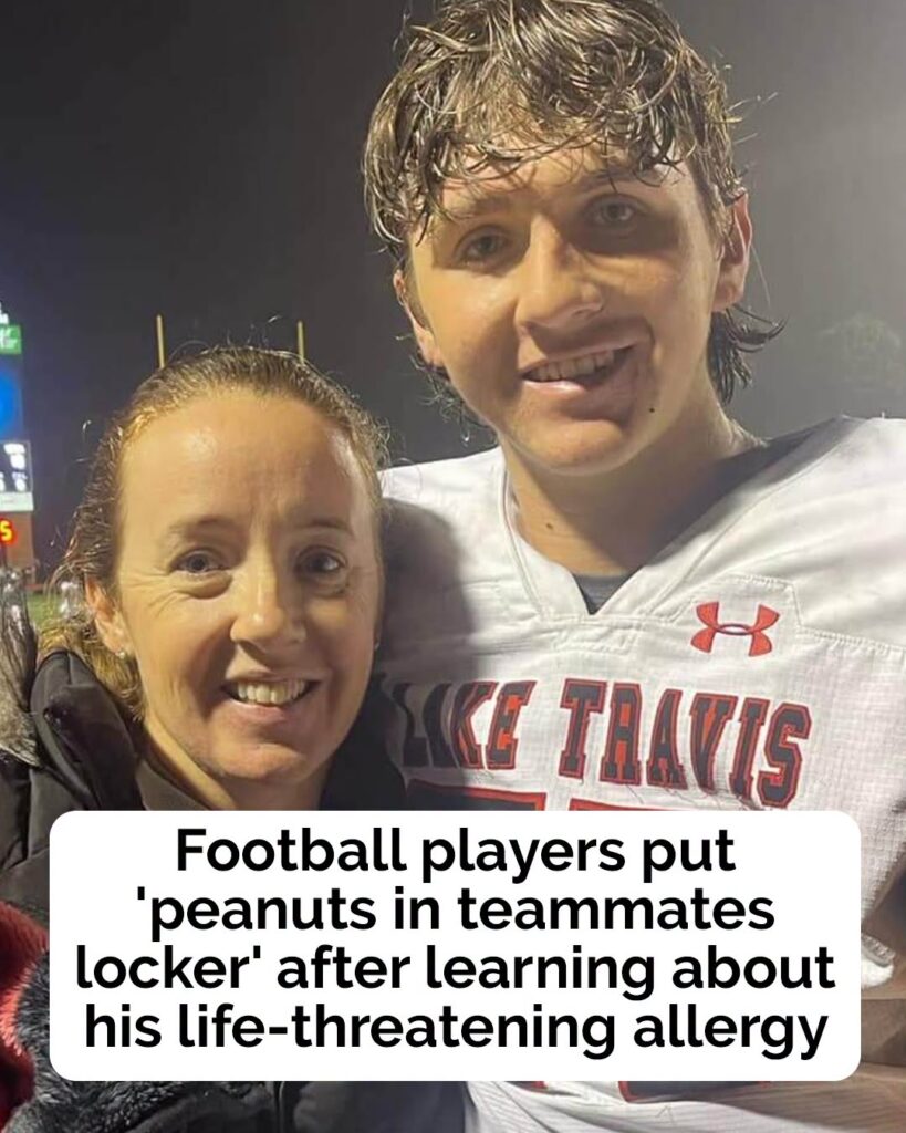 Football players “deliberately put peanuts in severely allergic teammate’s locker”
