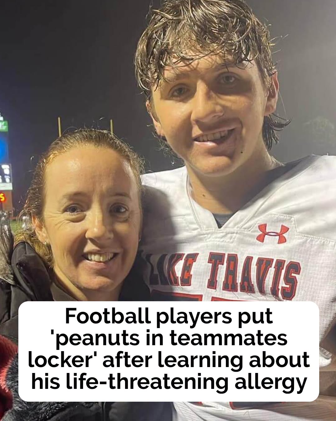 Football players “deliberately put peanuts in severely allergic teammate’s locker”