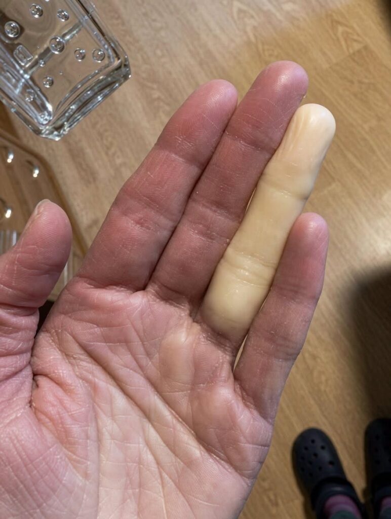 The Midnight Chill: Why You Might Wake Up with a Pale, Numb Finger (And How to Gently Restore Warmth and Circulation)