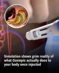 Simulation Shows How Ozempic Works Once It Enters Your Body