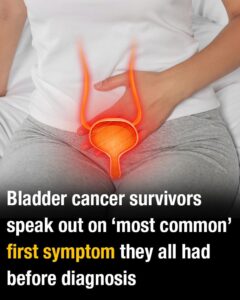 Bladder cancer survivors speak out on ‘most common’ first symptom they all had before diagnosis